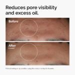 The Ordinary Niacinamide 10% + Zinc 1%, Smoothing Serum for Blemish-Prone Skin, 30 ml - Image 3